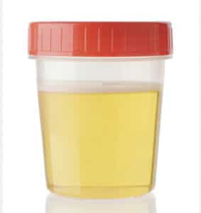 urine therapy