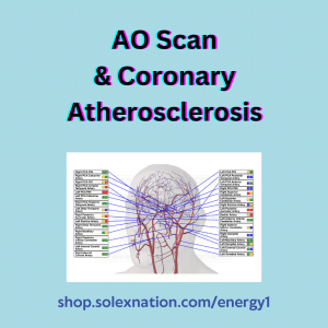 AO Scan Artery