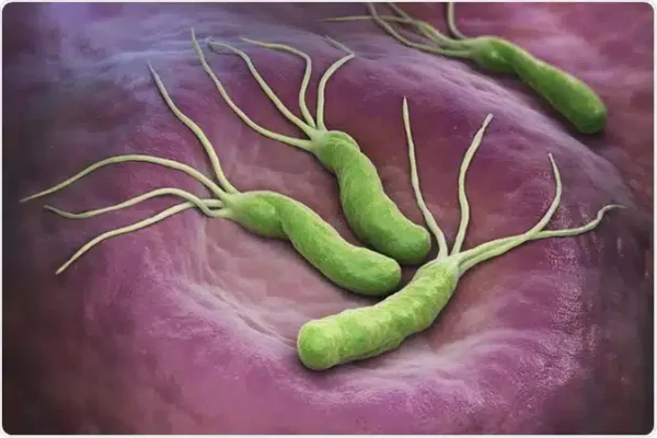 h-pylori