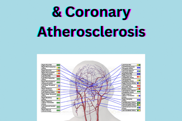 AO Scan Artery