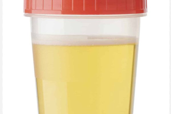 urine therapy