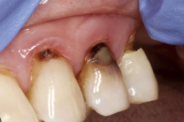 AO Dental Scan