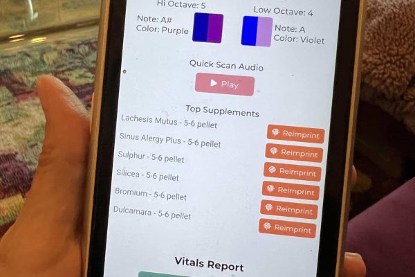 AO Scan technology