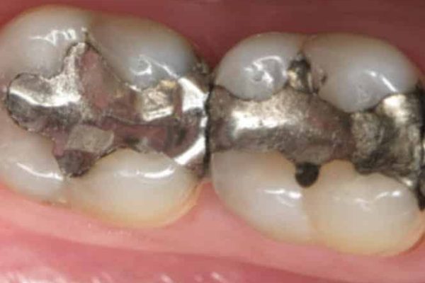 metal filings