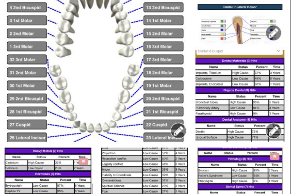 AO Dental Scan